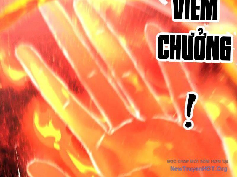 Gặp Mạnh Thì Càng Mạnh, Tu Vi Của Ta Không Giới Hạn