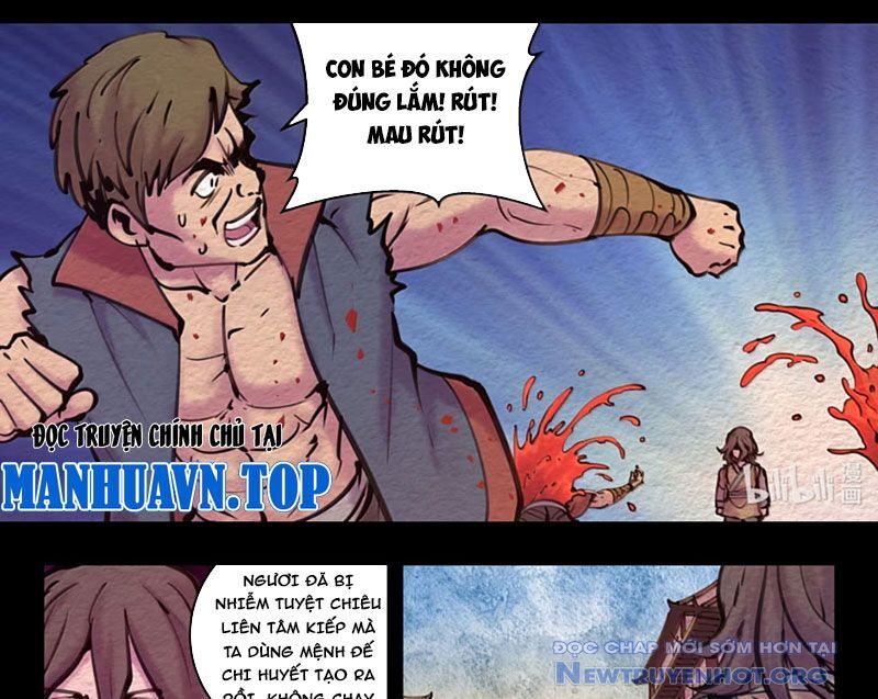 Côn thôn thiên hạ