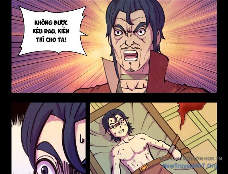 Côn thôn thiên hạ